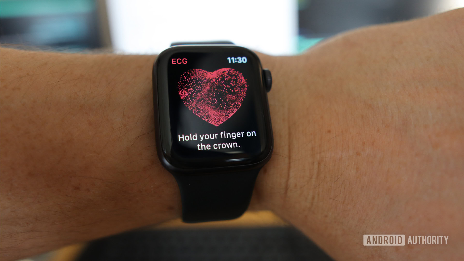 ECG Apple Watch App